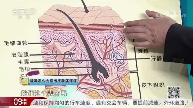 搓澡过度当心搓出皮肤病 