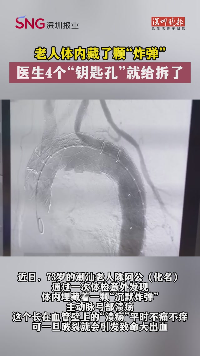 老人体内藏了颗“炸弹”，医生4个“钥匙孔”就给拆了！