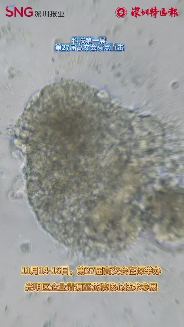 ber，你告诉我这颗“跳动心脏”竟是3D打印出来的？